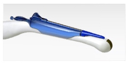 Endocavity Needle Guide Sterile, Disposable
