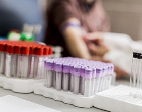 General Chemistry Reagent Glucose Oxidase For Clinical Chemistry Analyzers