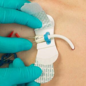 Catheter / Line Securement Device Grip-Lok