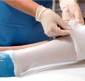 Stockinette Tubular Albahealth 5 Inch X 25 Yard Cotton NonSterile