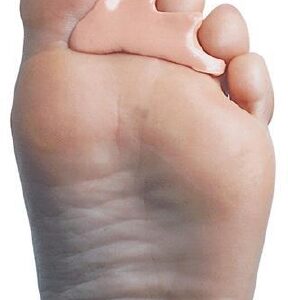 Moldable Footcare Compound PediPlast 100 Gm Jar