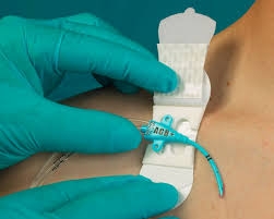 Catheter / Line Securement Device Grip-Lok
