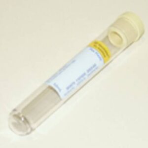 BD Vacutainer Urinalysis Tube Plain 10 mL Conventional Closure Plastic Tube