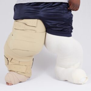 Reduction Kit circaid One Size Fits Most Beige Upper / Lower Leg / Lobe