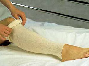 Stockinette Tubular Albahealth 6 Inch X 25 Yard Cotton NonSterile