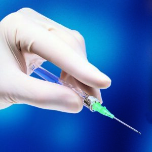 Peripheral IV Catheter Insyte Autoguard 20 Gauge 1.88 Inch BD Vialon Straight Hub Non Blood Control Push Button Safety