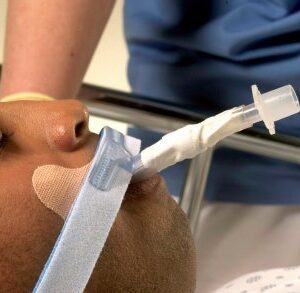 Endotracheal Tube Holder Stabilock 7mm to 10mm Adult