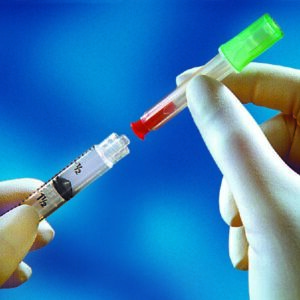 Dual Cannula with Syringe TwinPak Vial Access Pin / Blunt Tip Cannula 3 mL 20 Gauge Pin / 17 Gauge Cannula