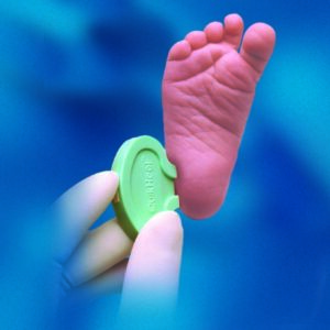 Pediatric Lancet BD Microtainer 2.5 mm Blade Retractable Push Button Activation Heel
