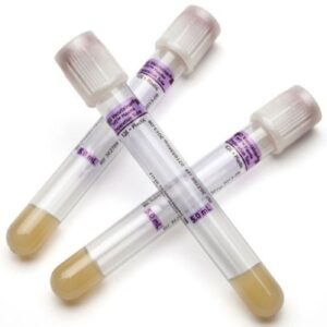 BD Vacutainer PPT Molecular Diagnostic Tube K2 EDTA / Separator Gel Additive 5 mL BD Hemogard Closure Plastic Tube