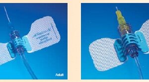IV Extension Set StatLock Needle-Free Port Micro Bore 6 Inch Tubing Without Filter Sterile