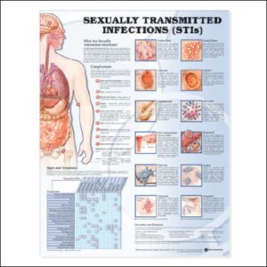 Anatomical Chart Sexually Transmitted Infections (STIS) 20 X 26 Inch Plastic Wall Mount Laminated
