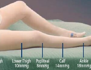 Anti-embolism Stocking T.E.D. Thigh High 2X-Large / Short White Inspection Toe