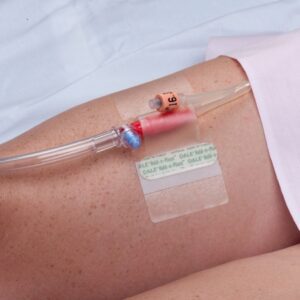Catheter Holder Hold-n-Place One Size Fits All, Adhesive Patch