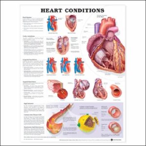 Anatomical Chart Heart Conditions 20 X 26 Inch Heavy Paper Laminated