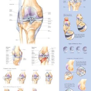 Anatomical Chart Knee Injuries 20 X 26 Inch Heavy Paper Laminated