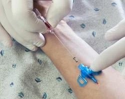 Closed IV Catheter Introcan Safety 3 20 Gauge 1 Inch Polyurethane Winged Hub Blood Control Passive Safety