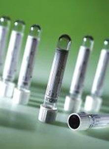 VACUETTE Z Serum Sep Clot Activator Venous Blood Collection Tube Clot Activator / Separator Gel Additive 5 mL Pull Cap Polyethylene Terephthalate (PET) Tube