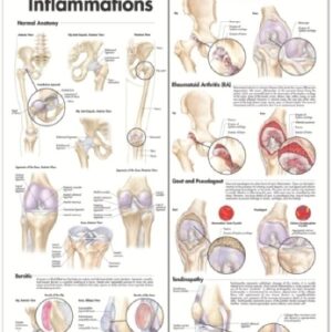 Anatomical Chart Hip and Knee 20 X 26 Inch Heavy Paper Grommets Laminated