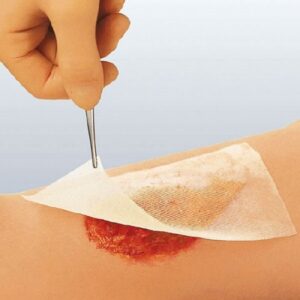 Oil Emulsion Impregnated Dressing Cuticerin Square 4 X 4 Inch Sterile