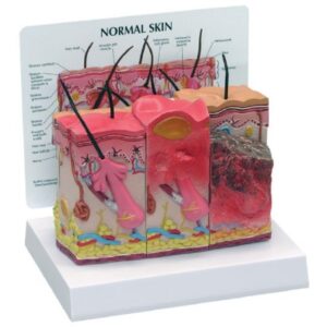 Skin Burn Normal Model Nasco