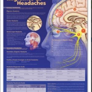 Anatomical Chart Migraines & Headaches 20 X 26 Inch Heavy Paper Grommets Laminated