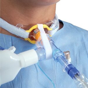 Tracheotomy Antidisconnect Device TrachStay