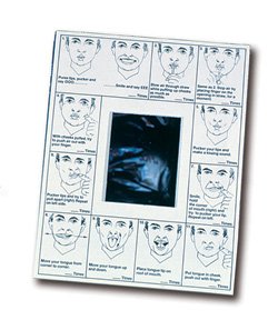 Mouth Exercise Chart Oral Images Oral Image with Mirror 8-1/2 X 11 Inch Paper