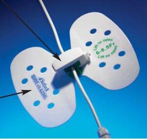Catheter / Line Securement Device Statlock Universal Plus