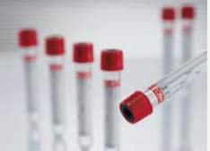 VACUETTE Z Serum Clot Activator Venous Blood Collection Tube Clot Activator Additive 9 mL Pull Cap Polyethylene Terephthalate (PET) Tube