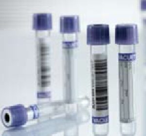 VACUETTE Venous Blood Collection Tube K3 EDTA Additive 9 mL Pull Cap Polyethylene Terephthalate (PET) Tube