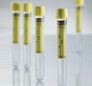 VACUETTE Urinalysis Tube Plain 9.5 mL Pull Cap Polyethylene Terephthalate (PET) Tube