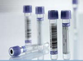 VACUETTE Venous Blood Collection Tube K2 EDTA Additive 4 mL Pull Cap Polyethylene Terephthalate (PET) Tube