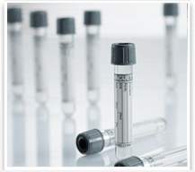 VACUETTE Venous Blood Collection Tube Sodium Fluoride / Potassium Oxalate Additive 4 mL Pull Cap Polyethylene Terephthalate (PET) Tube