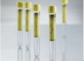VACUETTE Urinalysis Tube Plain 6.5 mL Screw Cap Polyethylene Terephthalate (PET) Tube