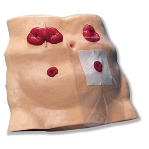 Ostomy Model Synthetic Tissue