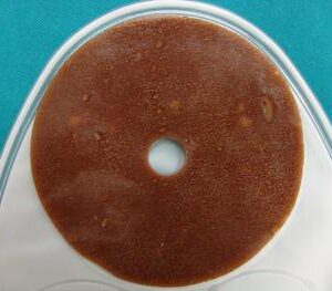 Skin Barrier Ring Atlantic